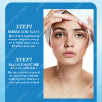 Acne Removal Cream Whitening Moisturizing Shrink Pores Oil Control Pimples Acne Treatment Gel Skin Care Face Cream