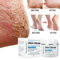 Urea Anti-Crack Frostbite Foot Cream Anti-Drying Crack Feet Ointment Heel Cracked Repair Removal Dead Skin Moisturizing Cream