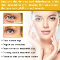 Sdotter Vitamin E Anti Wrinkle Eye Cream Fade Fine Lines Dark Circles Remove Eye Bags Puffiness Anti-Aging moisturizing Firm Eye