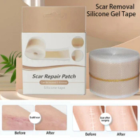 Efficient Beauty Scar Removal Silicone Gel Self-Adhesive Silicone Gel Tape Patch