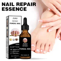 Nail Fungus Treatment Essence Anti Infection Paronychia Repair 30ml Care Onychomycosis Fungal Nourishing Foot Removal Hand B9Q0