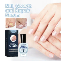 Nail Repair Liquid Fungul Nails Treatment Toenail Fungal Removal Liquid Anti Infection Cleaning Brightening Fingernails Repair