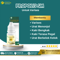 Propolis Sm Suplemen Kesehatan Untuk Varises Di Tangan/Kaki, Urat Menonjol Urat Tangan Bengkak Urat