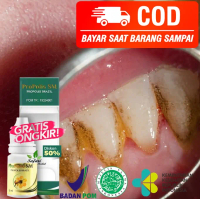 Obat Pembersih Karang Gigi, Pemutih Gigi Kuning & Hitam
