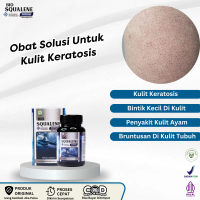 Suplemen Untuk Mengatasi Kulit Keratosis Pilaris, Bruntusan Di Kulit, Penyakit Kulit Ayam, Bintik Ke