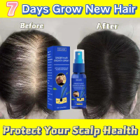 Xịt Mọc Tóc Kích Thích Mọc Tóc Xịt Mọc Tóc Chiết Xuất Gừng Ngăn Rụng Tóc Dưỡng Ẩm Da ĐầuTinh Chất Ng