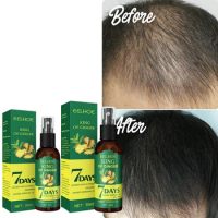 50ML Non-stimulate Ginger Hair Growth Spray Massage Scalp Repairing Damaged Hair Growth Serum Anti-shed Smooth Nourishing Liquid