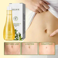 150ml Pregnancy Mark Repair Oil Deep Stretch Mark Removal With Olive Oil Safe Belly Skin Care Oil For Smooth Skin Scar Mark B2m3