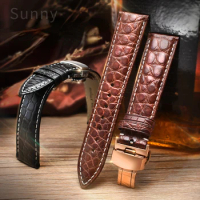 American Crocodile Watch Strap Men's and Women's Straps for Tissot Mido IWC Omega Watch Band Accessories 18 20 22mm
