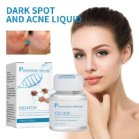 Dark Spot Fading Essence For Face Remover Melasma Freckles Pigment melanin moisturizeing repair brighten whiten dull skin serum