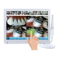 MLG M-978 PLUS  intra oral camera , sudah termasuk monitor touch screen , bisa connect ke HP.