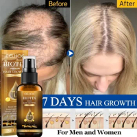 Fast Hair Growth Product Anti Hair Loss Castor Oil Serum Spray Prevent Baldness Treatment Scalp Beard Beauty Hair Care Men Women