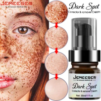 30ML Jemeesen Freckle Whitening Cream Lightens And Thinners Dark Spots To Remove Serum Fade Skin Melanin Reduces Age Skin Care