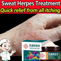 FUKANG viêm da dị ứng,vẩy nến.Chiết xuất từ thảo mộc tự nhiên 30g