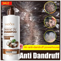 Dandruff Shampoo 500ml Oil Control Dry Shampoo Haircare Coconut Conditioner