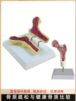 人體股骨骨質疏松解剖模型腿骨解剖面 脊柱切面標本 病變腰椎模型