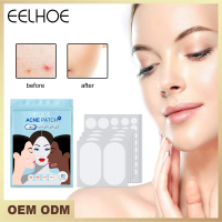 Eelhoe Acne Patch Makeup Invisible Anti-Acne Anti-Acne Closed Mouth Acne Waterproof Concealer Hydroc
