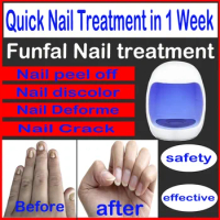 Fungal Nail Laser Device Repair Fast Nails Fungus Onychomycosis Essential Oil Repair Toenail Fingernail Anti Infection