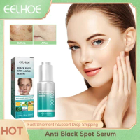 Dark Spots Remover Serum Anti Freckle Melasma Lighten Pigment Anti Aging Brightening Moisturizing Melanin Corrector Face Essence