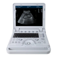 CONTEC CE CMS600P2PLUS Digital Notebook China ultrasound diagnostic system portable ultrasound scanner device