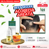 Propolis SM Untuk Rambut Rontok dan Rusak, Alopecia areata, penumbuh rambut pitak, botak koin, Peraw