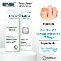 FREEDERM Gel / Lotion - Terbinafine For Athlete Foot & Kurap