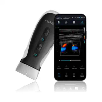 Pocket Color Ultrasound Scanner Android iOS Windows Portable Wifi Wireless Ultrasound with Changeable Ultrasound Heads