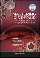 Mastering IRIS Repair: A Video Textbook of Iris Repair and Pupilloplasty Techniques  Agarwal 2020 Slack