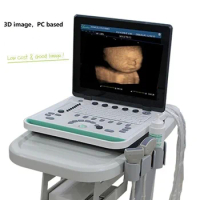 Li-Battery PC 3D Based 15 Inch Notebook Black and White Ultrasound Scanner Machine