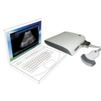 Ubox-10 professional portable ultrasonic diagnosis system