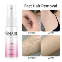 Hair Removal Cream Spray Health Safe Painless Hair Growth Inhibitor Summer Figure Beauty Hair Removal Portable Easy To Use Spray
