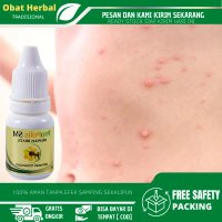 Salep Gatal Seluruh Badan, Gatal Berair, Gatal Bernanah, Bentol Bentol, Kulit Gatal Dengan Propolis 
