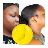 Chinese Herbal Ginseng Radiant Soft Skin Reduces Dark Spots Acne Pimples Melasma Gold Ginseng Lemon Facial Body Soap