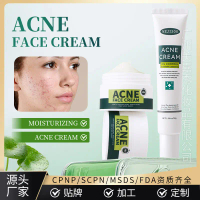 Acne Treatment Cream Acne Face Cream Smallpox Diluting Anti-Acne Cream Oil Control Cream Full Englis