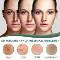 Sdottor New Eelhoe Natural Spot Cream Spot Fading Acne Moisture Replenishment Skin Whitening Brightening Skin Rejuvenation Skin