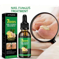 New Onychomycosis Foot Care Nail Fungus Removal Gel Anti Infection Nail Fungal Treatment Feet Care Essence