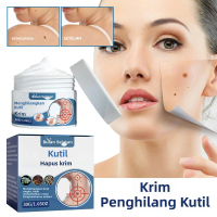 Krim Penghilang Kutil South Moon, Krim Pembersih Ringan untuk Kutil Filamen Granul Nevus di Kepala d