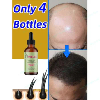 Biotin Hair Growth Products for Men Women Hair Loss Treatment Fast Grow Hair Spray Regrowth Thicken Oil Hair Care
