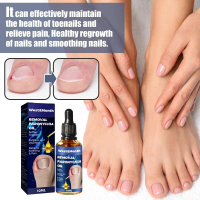 Anti Fungal Minyak Penjagaan Kuku Ingrown Toenail Relief Oil Corrector Stop Pain Onychomycosis Repai