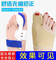 腳趾矯正器分大母腳趾頭足糾正大腳骨突出可以穿鞋男女士拇指外翻