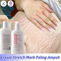 Stretch Mark Cream Krim Stretch Mark Pascamelahirkan Stretch Mark Pemudar Stretchmark PENGHILANG STR