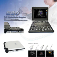 12 Inch LED Screen 2D Notebook Color Doppler Ultrasound Diagnostic System