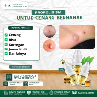 Cairan Tetes Untuk Cenang Bernanah, Cenang Di Tangan Dan Kaki, Cenang Berair, Kulit Nanahan, Penghil