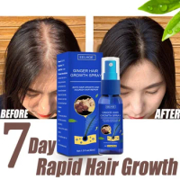 2022 Ginger Hair Grower spray Anti Hair Fall Hair Loss Treatment Hair Growth Essence Oil for Men Women