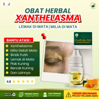 Obat Gumpalan Lemak Di Kelopak Mata, Xanthelasma, Milia Dekat Mata, Plak kekuningan di Dekat Mata, B