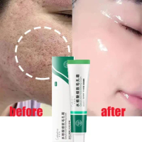 Salicylic Acid Shrink Pore Cream Quick Elimination Large Pores Remove Blackehead Tighten Face Smooth Repairingskin Care Products