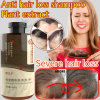 Anti-hair Loss Shampoo Herbal Essence Shampoo Improves Hair Loss, Removes Dandruff, Relieves Itching, Smoothes and Controls Oil