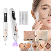 Skin Tag Remover เลเซอร์พลาสม่าปากกา Facial Freckle Mole จุดสีดํา Remover Tattoo Nevus Wart Eliminat