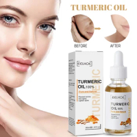 30ml Turmeric Oil Acne Dark Spot Removal Skin Care Lightening Whitening Serum Anti-Wrinkle Aging Face Lifting Pigment Corrector