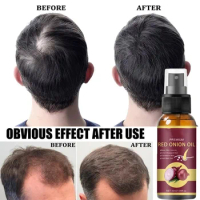 Anti Hair Loss Treatment Oil Powerful Hair Growth Serum Spray Repair Hair Nourish Root Regrowth Hair For Men Women Hair Care